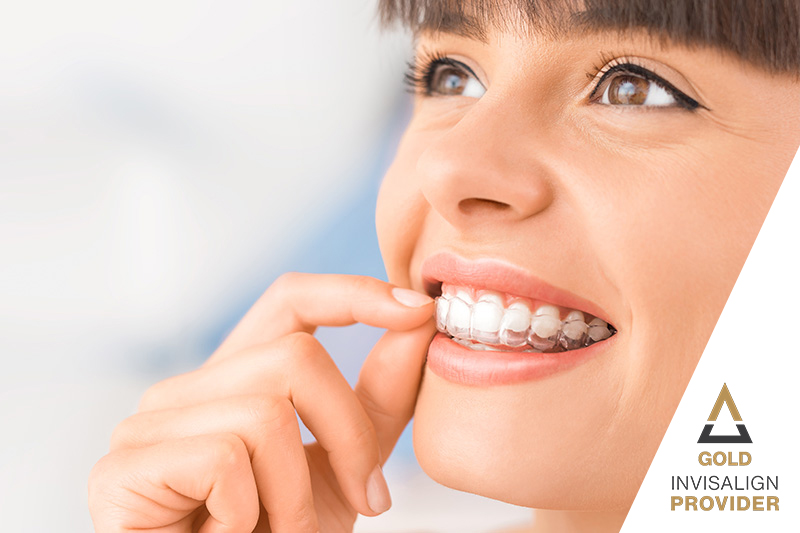 Invisalign in Fountain Valley